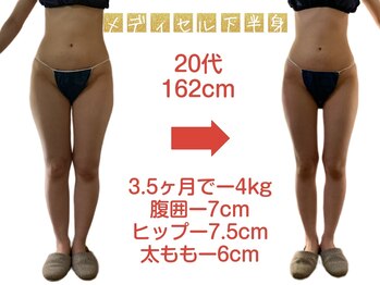 トータルボディケア ナゴミ 六条本店(和)/20代 メディセル×栄養指導