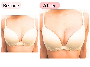 ピーグランディ 栄店(p-Grandi)/【お悩み】バストサイズ