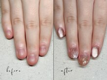 ユユネイル(yuyu nail)/【深爪育成】長さ出し＋アート