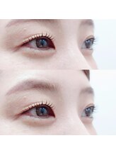 エネル バイ アルト(eneru by arto)/まつ毛パーマ