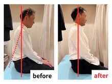 四条大宮アシスト鍼灸整骨院/全身整体ビフォーアフター