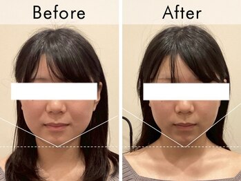 ハリラウンジ 恵比寿本店(Hari Lounge)/美容鍼専門サロン Hari Lounge