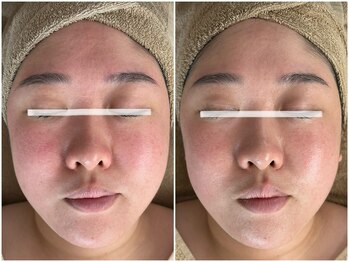 メイン(main)/★before after★