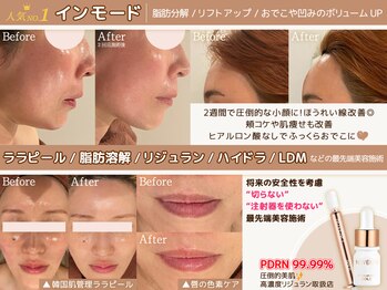 ミーカラー(mecalla.)