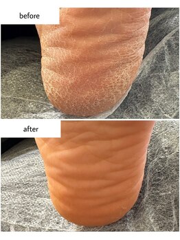 ケアプラス(care plus)/足裏角質ケア