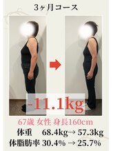 ウェルネ 田原院/60代のビフォーアフター