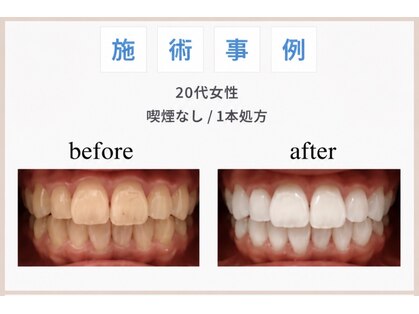 サロン ド ホワイト(Salon de White)の写真