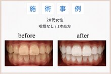 サロン ド ホワイト(Salon de White)