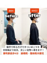 木犀花/座るだけで肩こり、猫背になる方