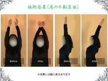 ボディ リセット アンド デザイン(Body Reset & Design)/【施術例】ビフォーアフター