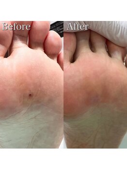 巻き爪補正店 町田店/