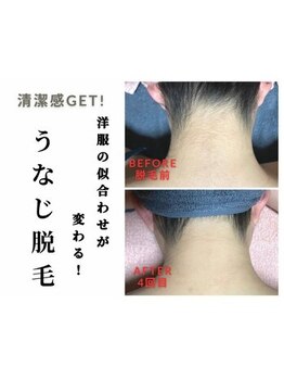 ミラク(MIRAC)/うなじ脱毛♪