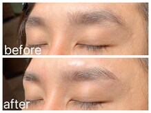 クラシックス(CLASSICS)/美眉ワックス脱毛