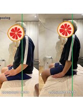 グレフル鍼灸接骨院 整体院 心斎橋/整体/肩こり/マッサージ/腰痛