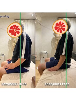 グレフル鍼灸接骨院 整体院 心斎橋/整体/肩こり/マッサージ/腰痛