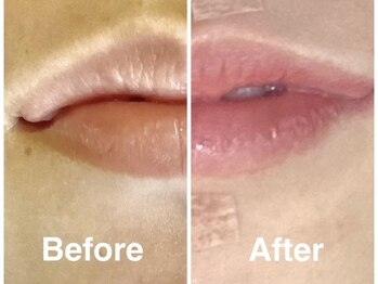 三美創ビューティースタジオ 富山店/唇・乳輪・ＶＩＯの黒ずみ除去