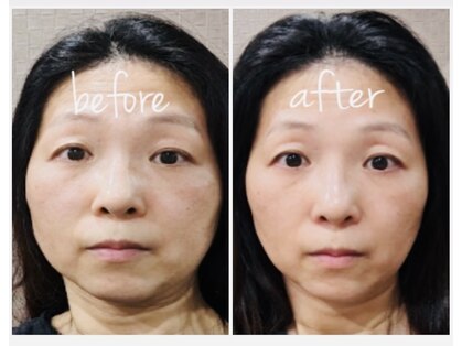 ビースマイル(Be-Smile)の写真