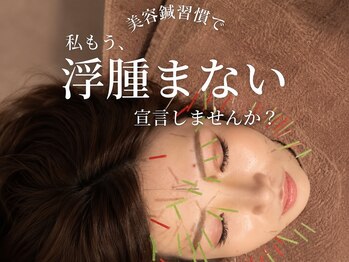 ルディア 堂島店(ledia)/大阪美容鍼で浮腫まない宣言