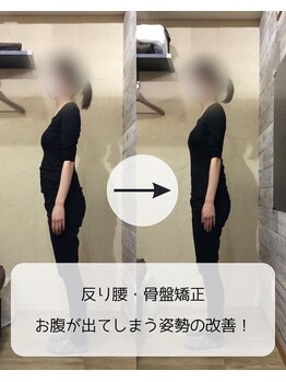伊集院鍼灸整骨院 千葉中央院/反り腰・骨盤矯正
