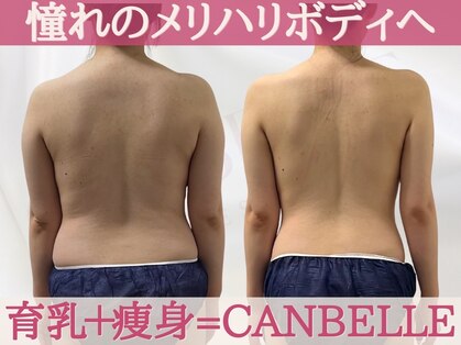 キャンベル(CANBELLE)の写真