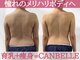 キャンベル(CANBELLE)の写真