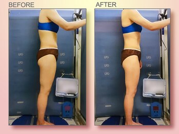 ジュリア オージェ 梅田店/ビフォーアフター(脂肪燃焼)