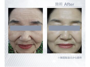 キラディ(KILADY)/憧れの韓国美肌を手に入れる！