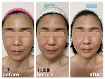 ダルセーニョ/若さ上昇★高揚感に包まれます！