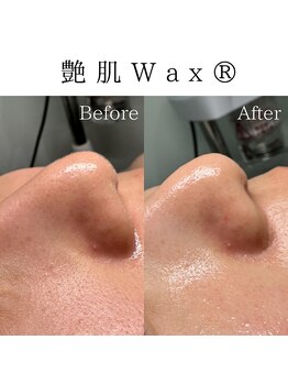 ビューティービューティー(BEAUTY BEAUTY)/艶肌ワックス