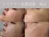 【最強美白】 直後から白さを実感☆透明感UPピーリングで透き通る美肌に！