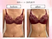 リール 恵比寿店(RIRE)/バストアップ症例【広尾恵比寿】