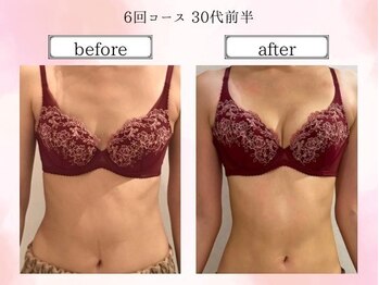 リール 恵比寿店(RIRE)/バストアップ症例【広尾恵比寿】