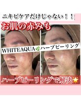 ホワイトアクア 新宿本店(WHITE AQUA)/ハーブピーリング/東京/新宿