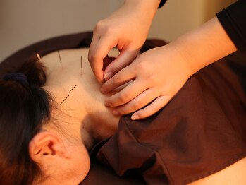 ウェルクス(welux)/