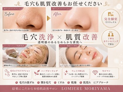 ロミエール(LOMIERE)の写真