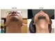 デサフィオ(Desafio.sln)の写真/【結果重視＆濃ゆい毛専門店★】男性もVIO含めた全身まるごとしっかり脱毛可能！満足度◎部分お試し￥1000
