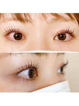 アディクト 恵比寿店(ADDICT)/ケラチンラッシュリフト上下