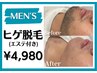 メンズ専用 待望の髭脱毛が新登場★毛質に合わせたカスタマイズ照射¥4,980