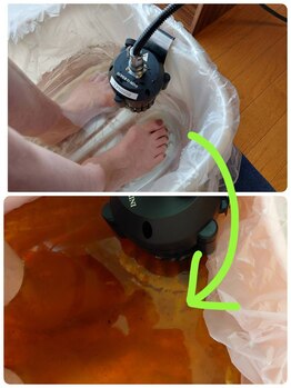 ビアンカーラ(Biancara)/【イオンデトックス足湯】