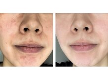 スリリアン 銀座/★お客さまビフォーアフター★