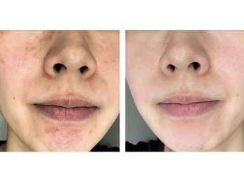 スリリアン 銀座/★お客さまビフォーアフター★