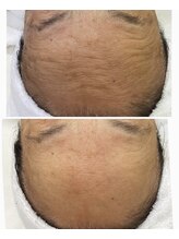 レア(Lea)/シワも改善