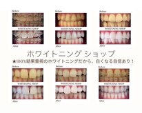 ホワイトニングショップ 亀岡店
