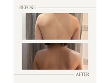 ブルーム(B.LOOM)/肩周りストレッチ/全身リンパ