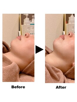 ラピス 新宿/レモンボトル