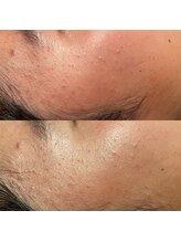 骨盤ダイエットサロン カンフリエ(camphrier)/ダクトピール