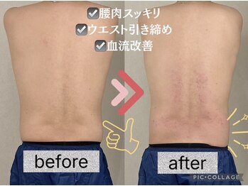 イヨヨ(iyoyo)/【痩身】Before After