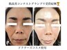【5000円金券プレゼント付】ノーファンデプログラムフェイシャル特価体験