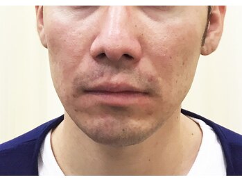 プリンセス バイ セイフティプリンセス 長野店(PRINCESS)/《男性にも人気》小顔矯正