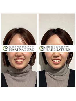 ハリナチュレ 梅田店(HARINATURE)/浮腫改善にも◎